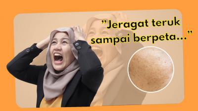 Jeragat teruk